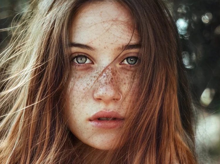 Clear, even skin after pico laser imperfection removal