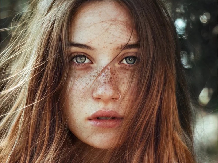 Clear, even skin after pico laser imperfection removal